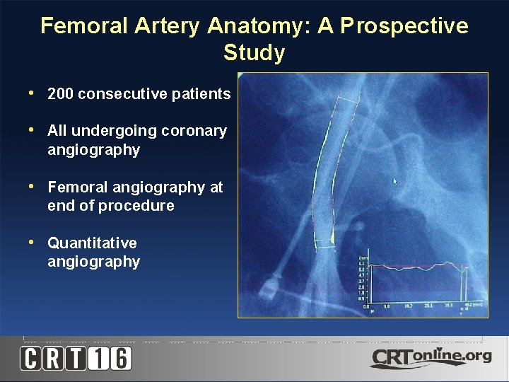 Femoral Artery Anatomy: A Prospective Study • 200 consecutive patients • All undergoing coronary