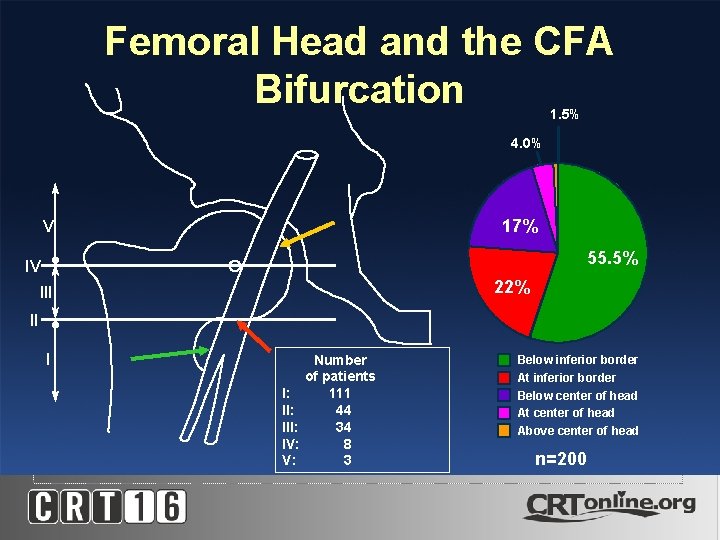 Femoral Head and the CFA Bifurcation 1. 5% 4. 0% 17% V 55. 5%