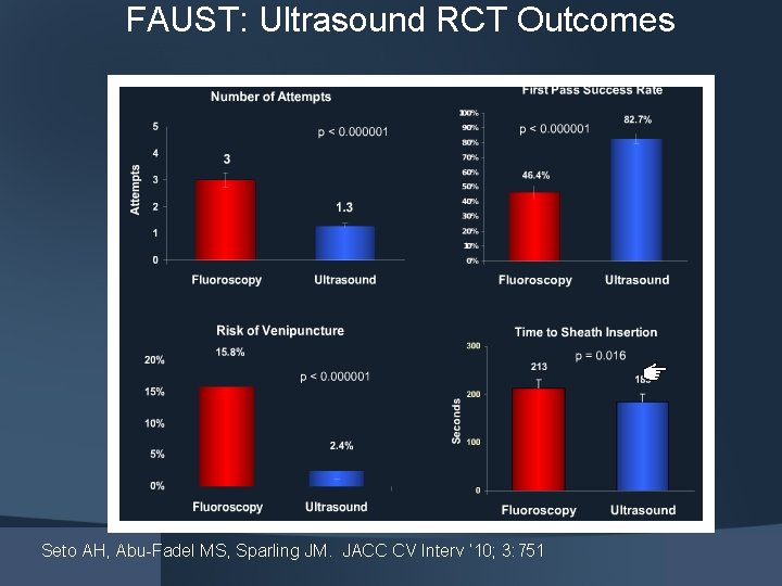FAUST: Ultrasound RCT Outcomes Seto AH, Abu-Fadel MS, Sparling JM. JACC CV Interv ’