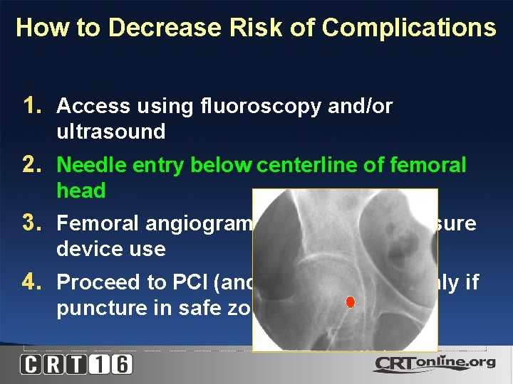How to Decrease Risk of Complications 1. Access using fluoroscopy and/or ultrasound 2. Needle