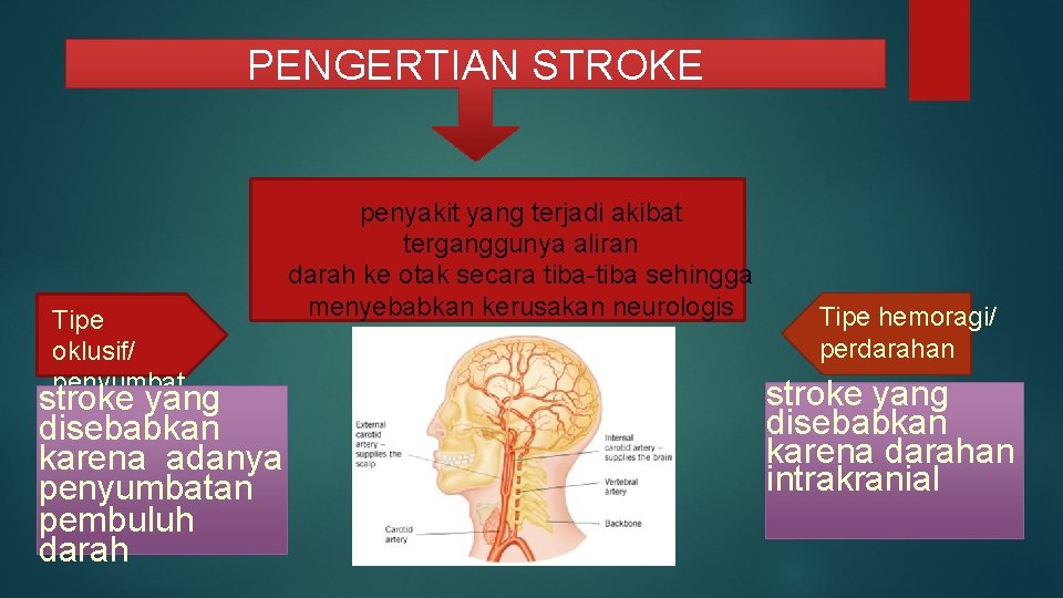PENGERTIAN STROKE Tipe oklusif/ penyumbat stroke yang an disebabkan karena adanya penyumbatan pembuluh darah