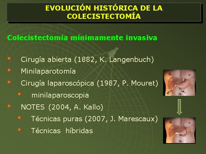 EVOLUCIÓN HISTÓRICA DE LA COLECISTECTOMÍA Colecistectomía mínimamente invasiva • • Cirugía abierta (1882, K.