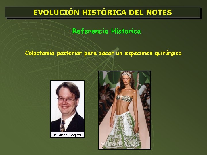 EVOLUCIÓN HISTÓRICA DEL NOTES Referencia Historica Colpotomía posterior para sacar un especimen quirúrgico 