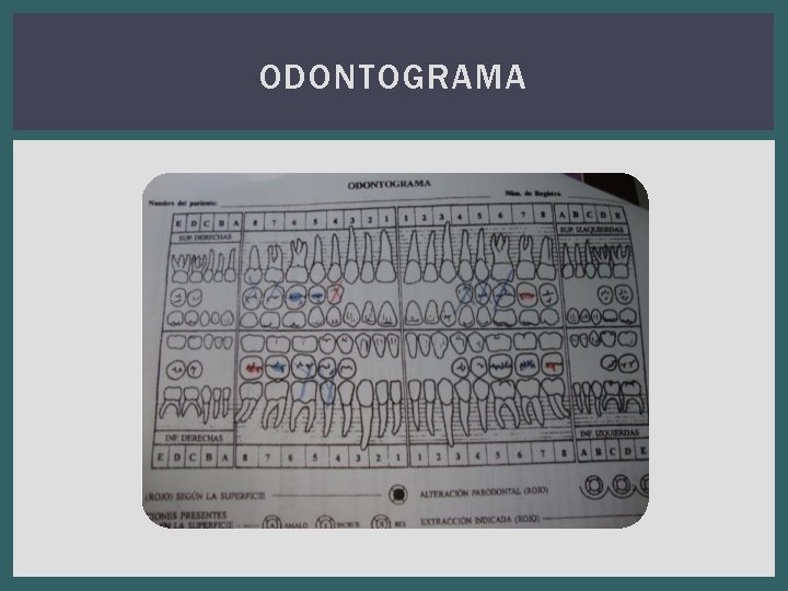 ODONTOGRAMA 