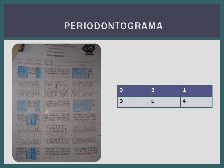 PERIODONTOGRAMA 3 3 1 4 