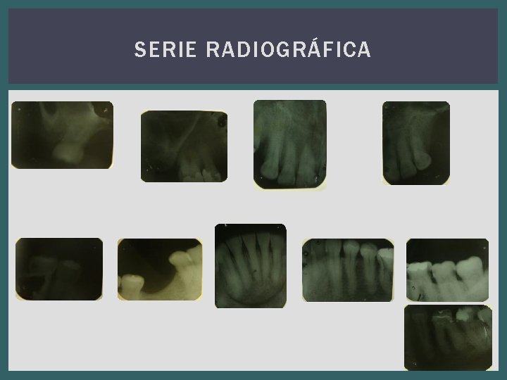 SERIE RADIOGRÁFICA 