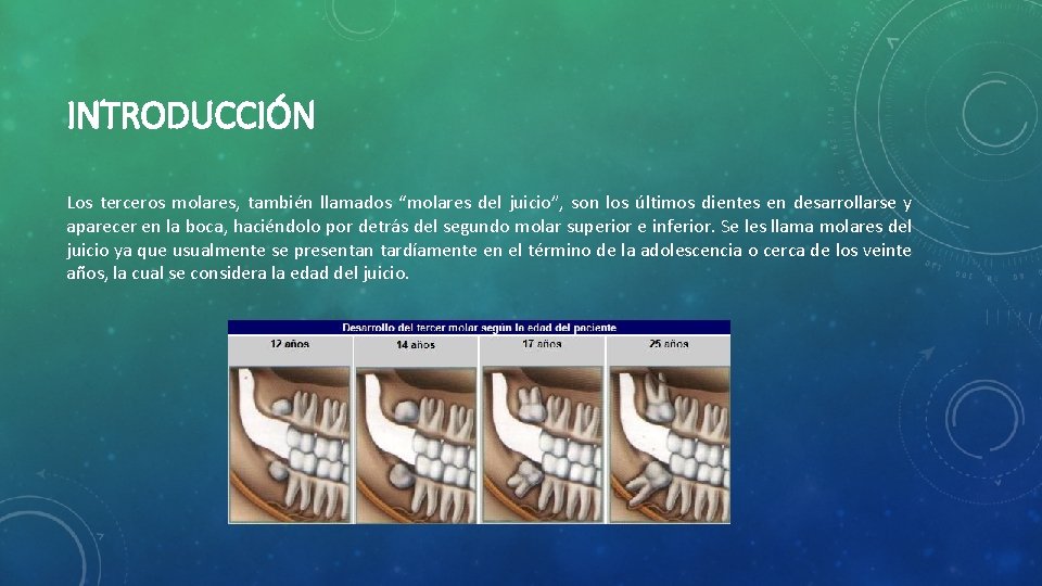 INTRODUCCIÓN Los terceros molares, también llamados “molares del juicio”, son los últimos dientes en