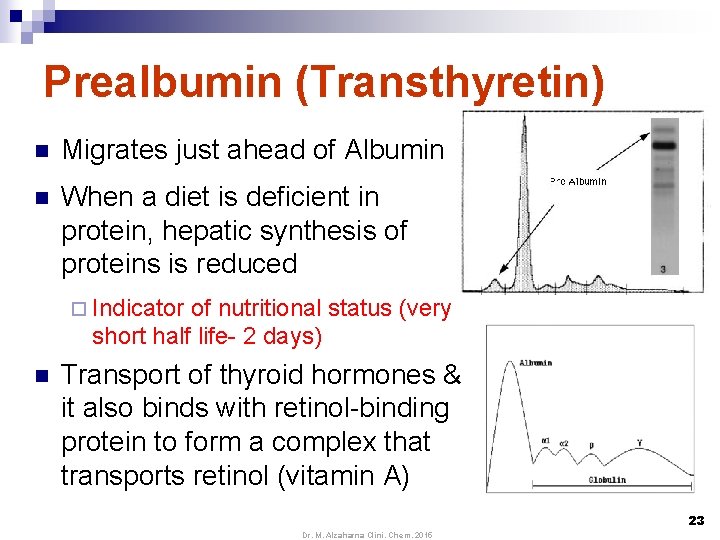 Prealbumin (Transthyretin) n Migrates just ahead of Albumin n When a diet is deficient