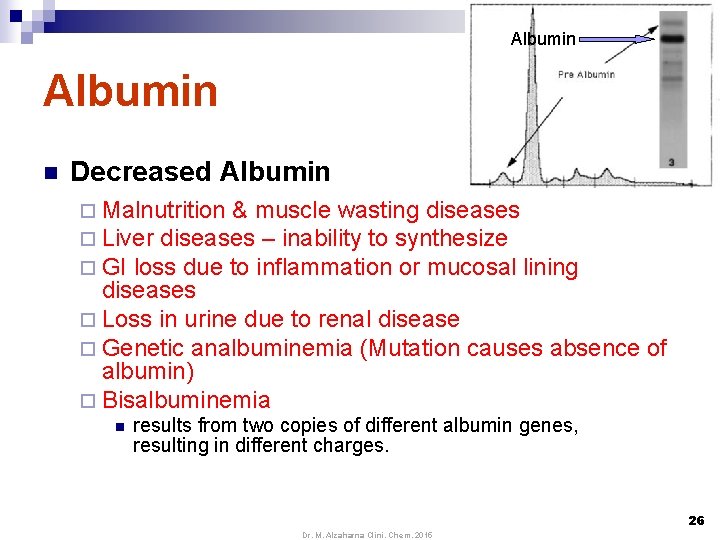 Albumin n Decreased Albumin ¨ Malnutrition & muscle wasting diseases ¨ Liver diseases –