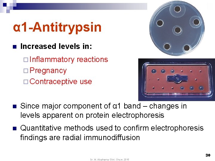 α 1 -Antitrypsin n Increased levels in: ¨ Inflammatory reactions ¨ Pregnancy ¨ Contraceptive