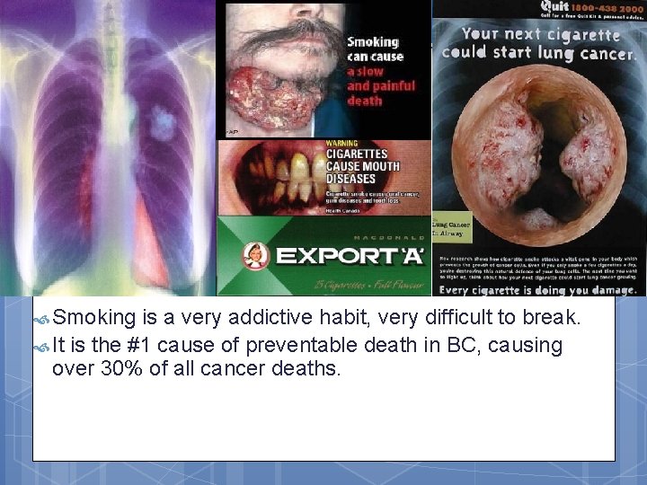  Smoking is a very addictive habit, very difficult to break. It is the