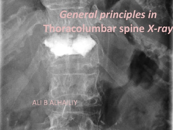 General principles in Thoracolumbar spine X-ray ALI B ALHAILIY 