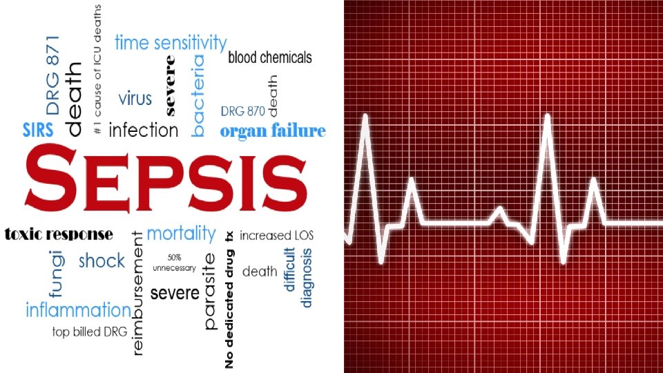 Sepsis Sepsis