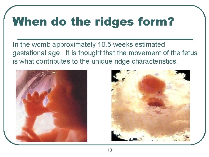 When do the ridges form? In the womb approximately 10. 5 weeks estimated gestational