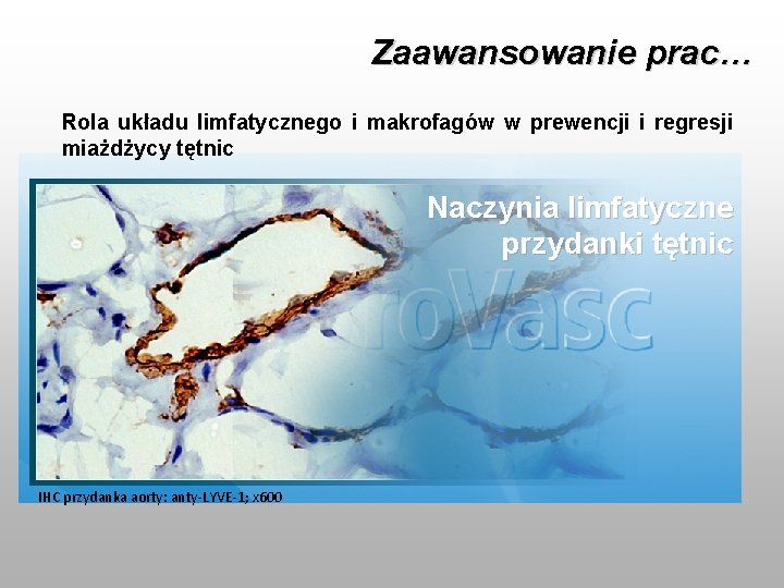 Zaawansowanie prac… Rola układu limfatycznego i makrofagów w prewencji i regresji miażdżycy tętnic Naczynia