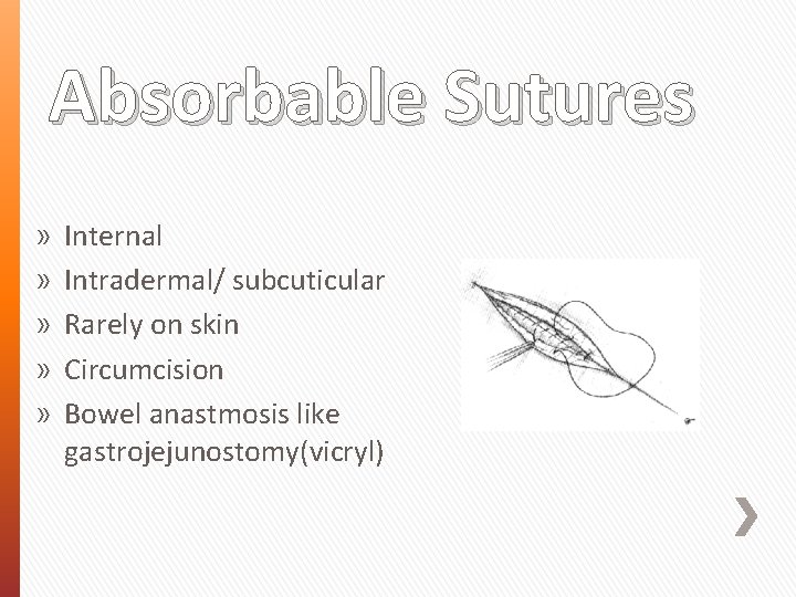Absorbable Sutures » » » Internal Intradermal/ subcuticular Rarely on skin Circumcision Bowel anastmosis
