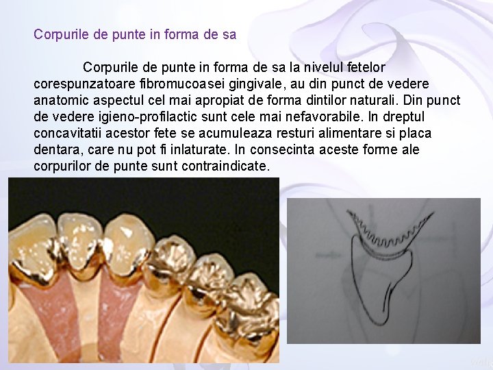 Corpurile de punte in forma de sa la nivelul fetelor corespunzatoare fibromucoasei gingivale, au