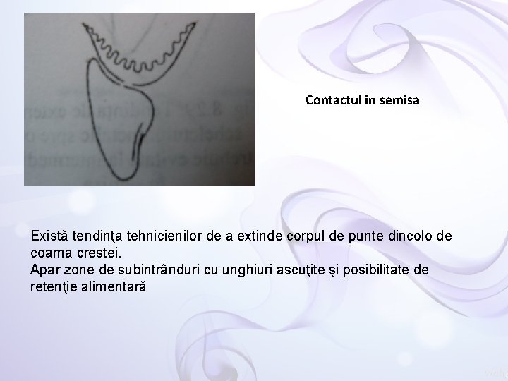 Contactul in semisa Există tendinţa tehnicienilor de a extinde corpul de punte dincolo de