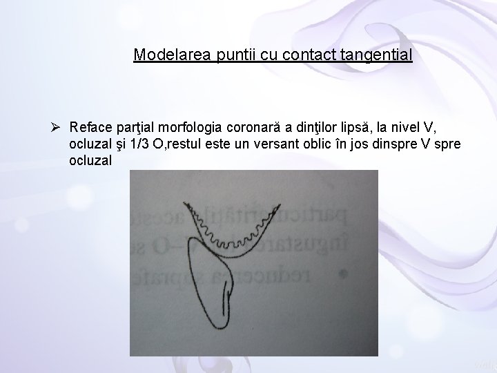 Modelarea puntii cu contact tangential Ø Reface parţial morfologia coronară a dinţilor lipsă, la