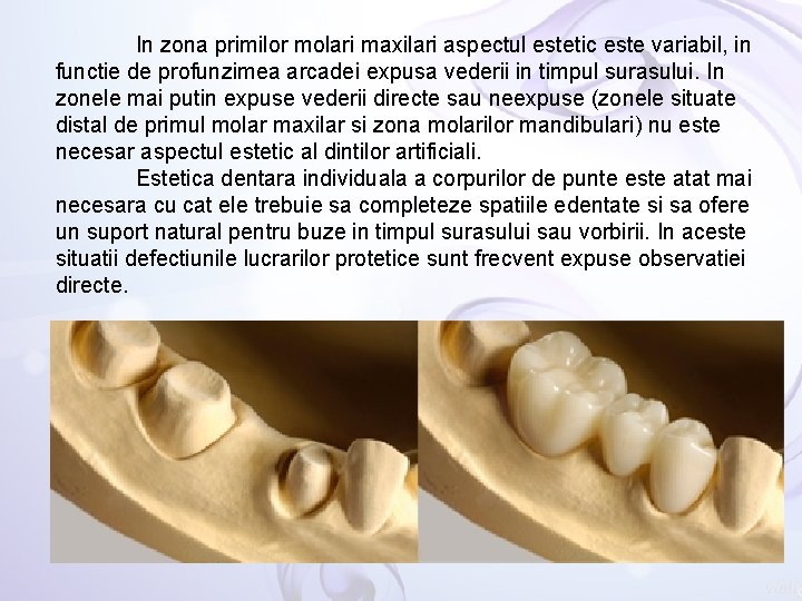 In zona primilor molari maxilari aspectul estetic este variabil, in functie de profunzimea arcadei