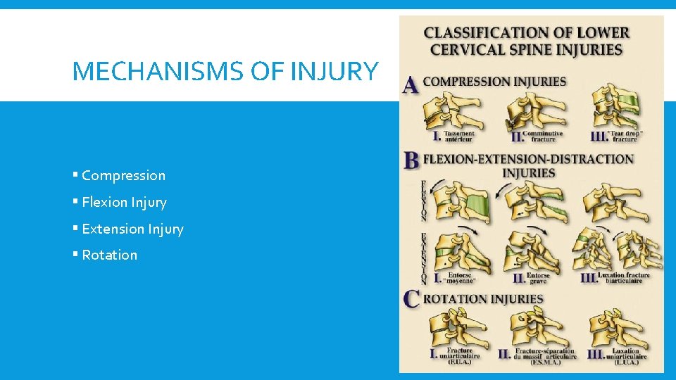 MECHANISMS OF INJURY § Compression § Flexion Injury § Extension Injury § Rotation 