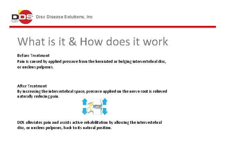 Disc Disease Solutions, Inc What is it & How does it work Before Treatment