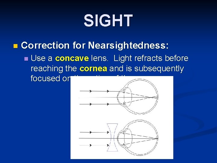 SIGHT n Correction for Nearsightedness: n Use a concave lens. Light refracts before reaching