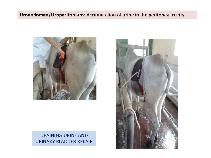 Uroabdomen/Uroperitonium: Accumulation of urine in the peritoneal cavity DRAINING URINE AND URINARY BLADDER REPAIR