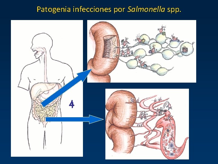 Patogenia infecciones por Salmonella spp. 4 Patogenia infecciones por Salmonella spp. 4