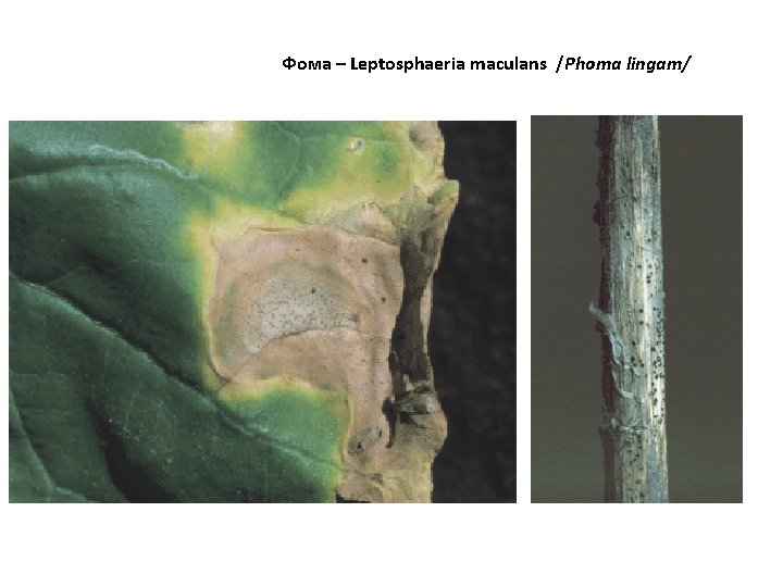 Фома – Leptosphaeria maculans /Phoma lingam/ 