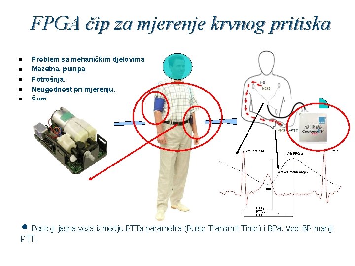 FPGA čip za mjerenje krvnog pritiska n n n • Problem sa mehaničkim djelovima,