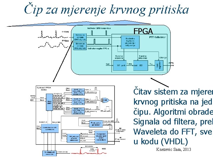 Čip za mjerenje krvnog pritiska FPGA Čitav sistem za mjeren krvnog pritiska na jedn