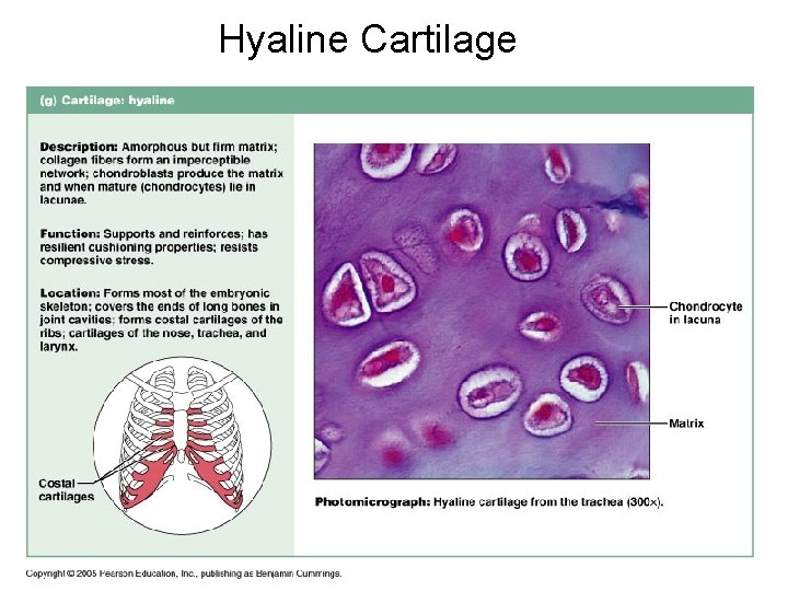 Hyaline Cartilage 