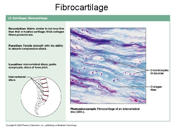 Fibrocartilage 