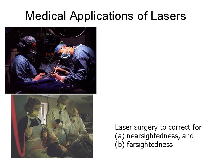 Medical Applications of Lasers Laser surgery to correct for (a) nearsightedness, and (b) farsightedness