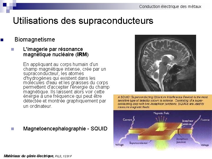 Conduction électrique des métaux Utilisations des supraconducteurs Biomagnetisme n n L'imagerie par résonance magnétique