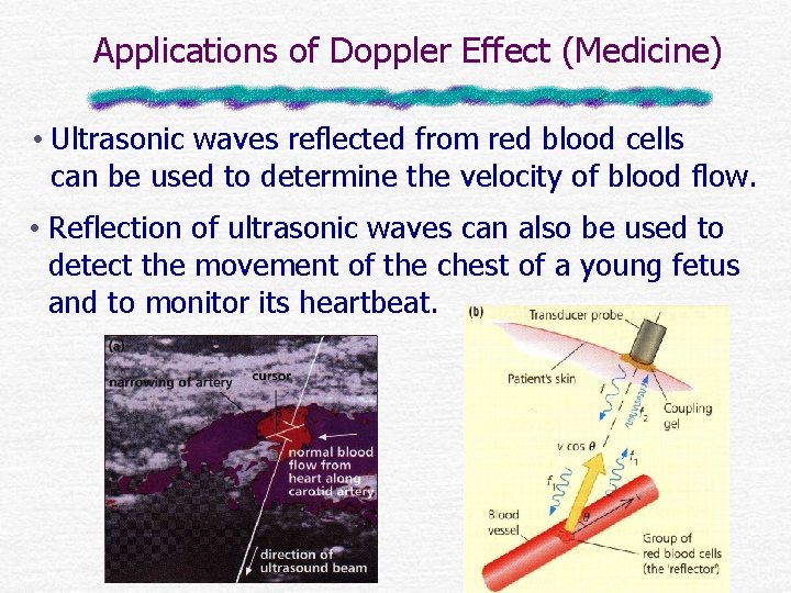 Applications of Doppler Effect (Medicine) • Ultrasonic waves reflected from red blood cells can