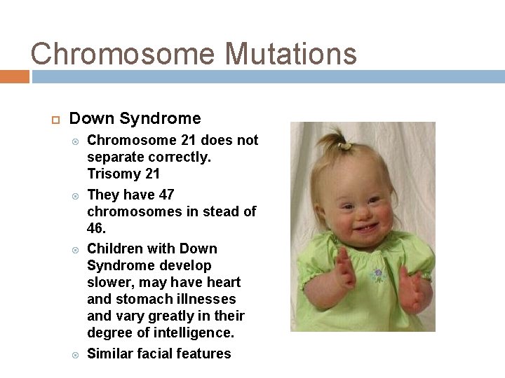 Chromosome Mutations Down Syndrome Chromosome 21 does not separate correctly. Trisomy 21 They have