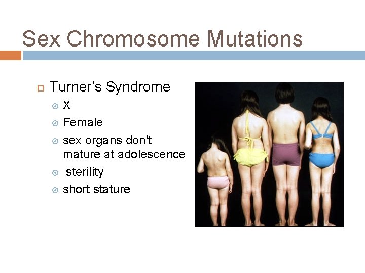 Sex Chromosome Mutations Turner’s Syndrome X Female sex organs don't mature at adolescence sterility