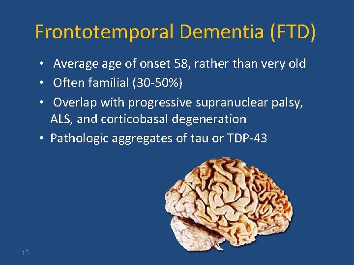 Frontotemporal Dementia (FTD) • Average of onset 58, rather than very old • Often