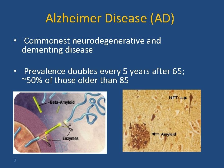 Alzheimer Disease (AD) • Commonest neurodegenerative and dementing disease • Prevalence doubles every 5