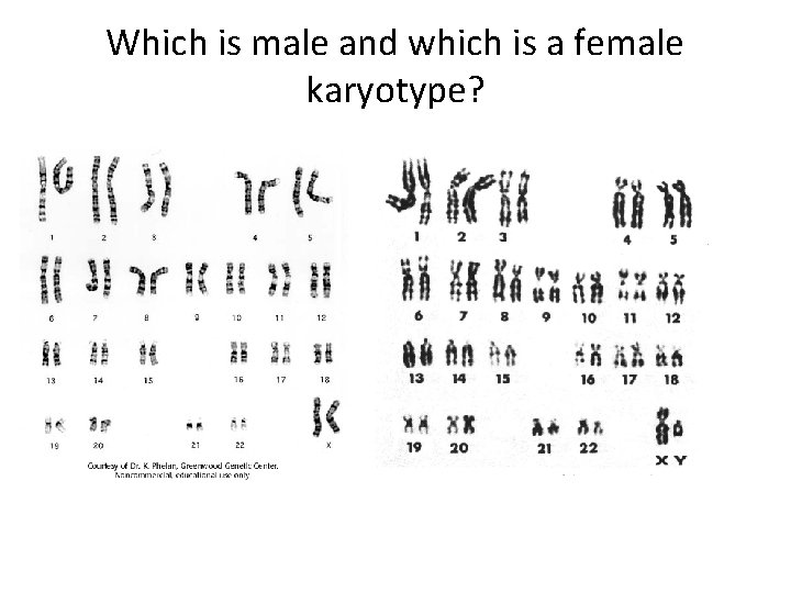 Which is male and which is a female karyotype? 