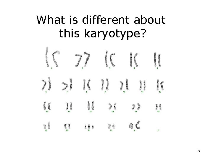 What is different about this karyotype? 13 