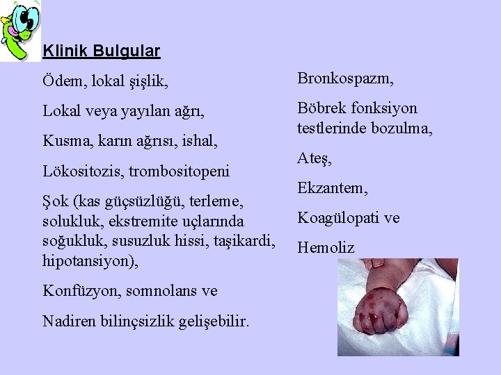 Klinik Bulgular Ödem, lokal şişlik, Bronkospazm, Lokal veya yayılan ağrı, Böbrek fonksiyon testlerinde bozulma,