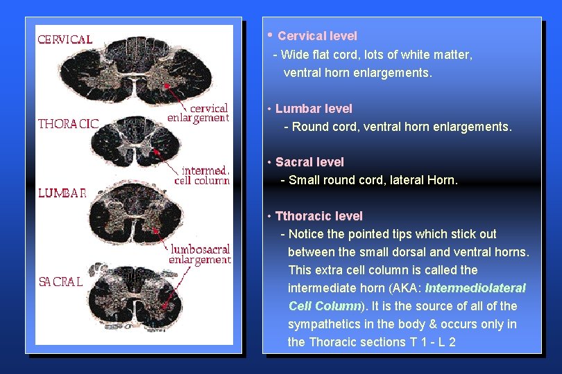  • Cervical level - Wide flat cord, lots of white matter, ventral horn