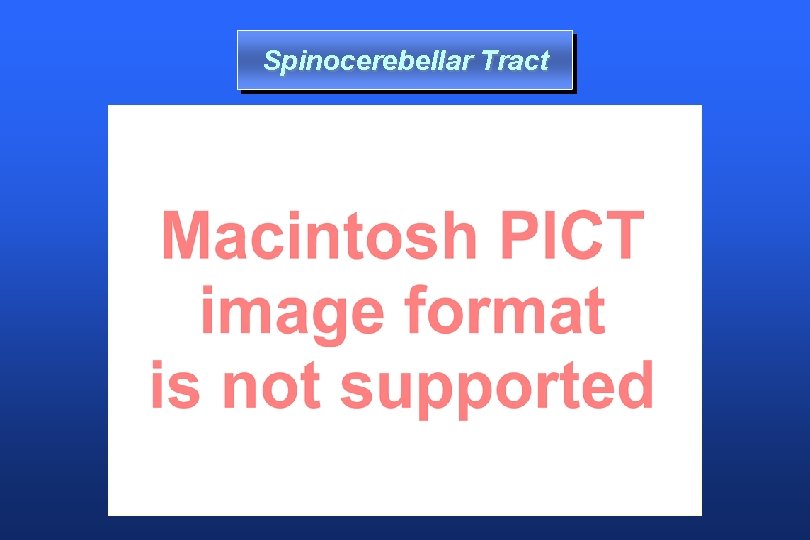 Spinocerebellar Tract 