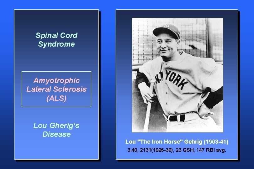 Spinal Cord Syndrome Amyotrophic Lateral Sclerosis (ALS) Lou Gherig’s Disease Lou "The Iron Horse"