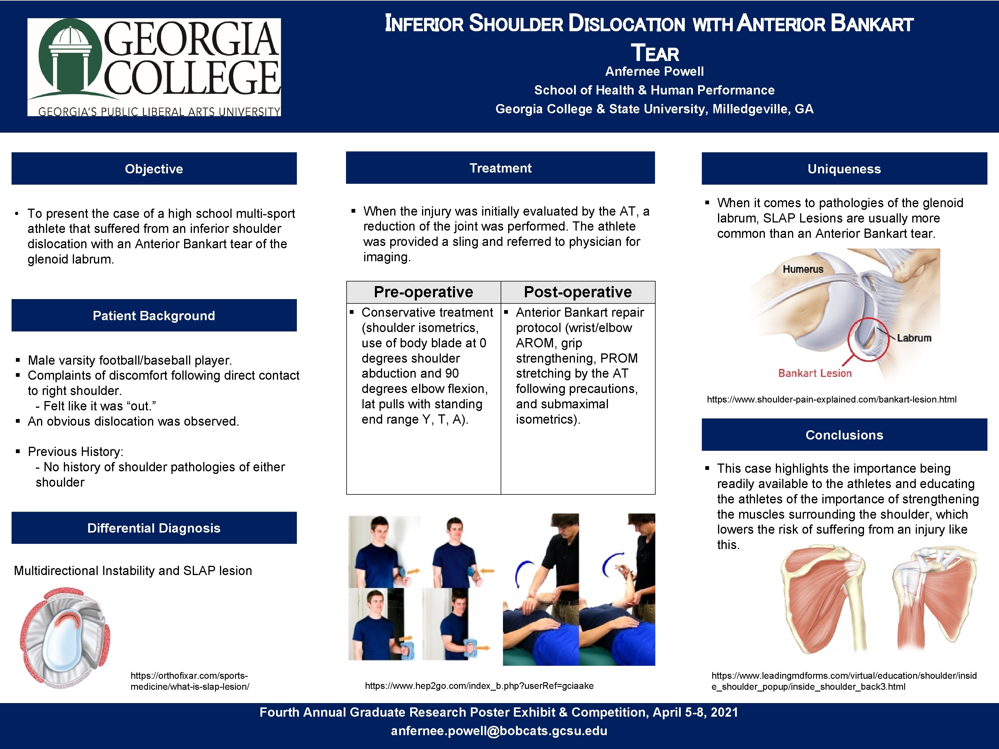 INFERIOR SHOULDER DISLOCATION TEAR WITH ANTERIOR BANKART Anfernee Powell School of Health & Human