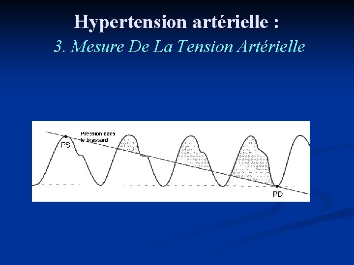 Hypertension artérielle : 3. Mesure De La Tension Artérielle 