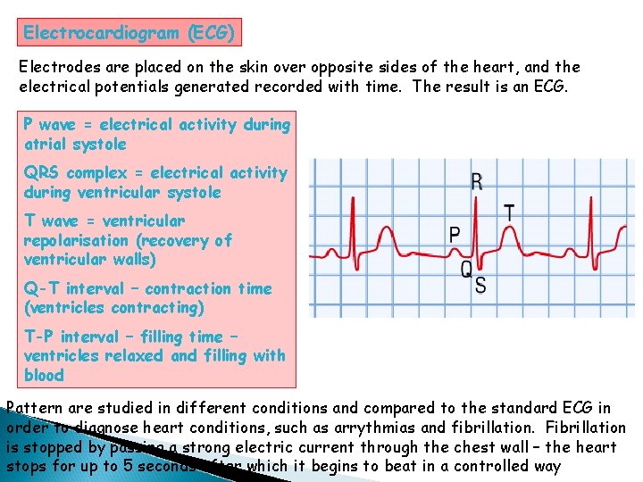 Electrocardiogram (ECG) Electrodes are placed on the skin over opposite sides of the heart,